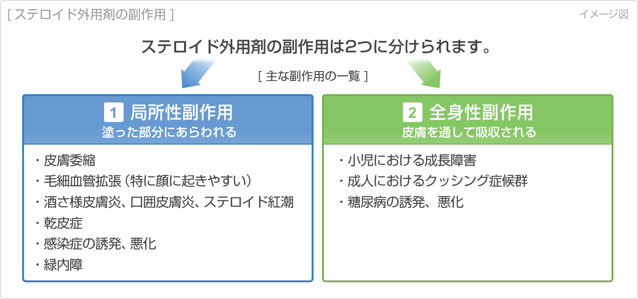 ステロイド外用剤の副作用