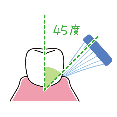 バス法のイラスト1