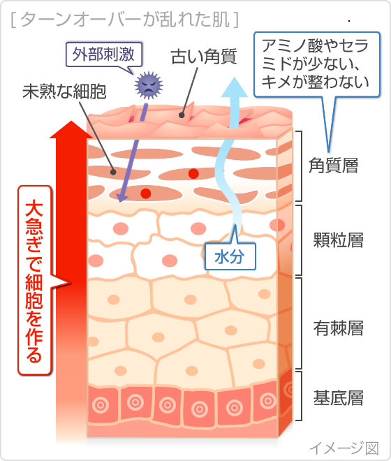 ターンオーバーが乱れた肌