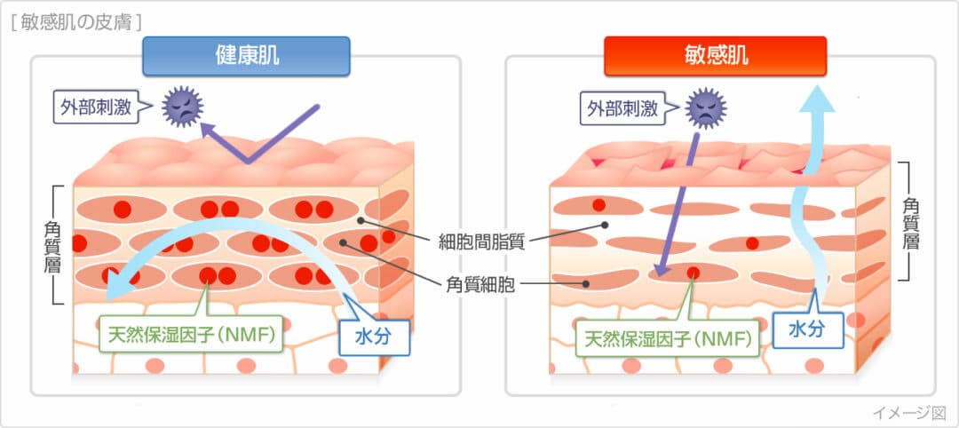 健康肌と敏感肌の状態を表したイラスト