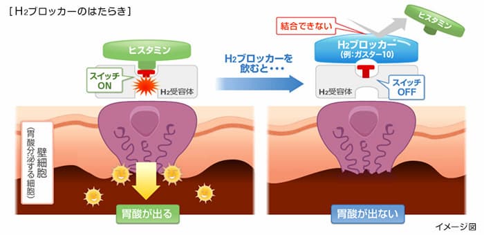 H2ブロッカーのはたらき（イメージ図）