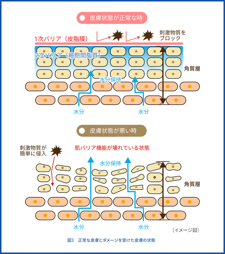 図2　正常な皮膚とダメージを受けた皮膚の状態