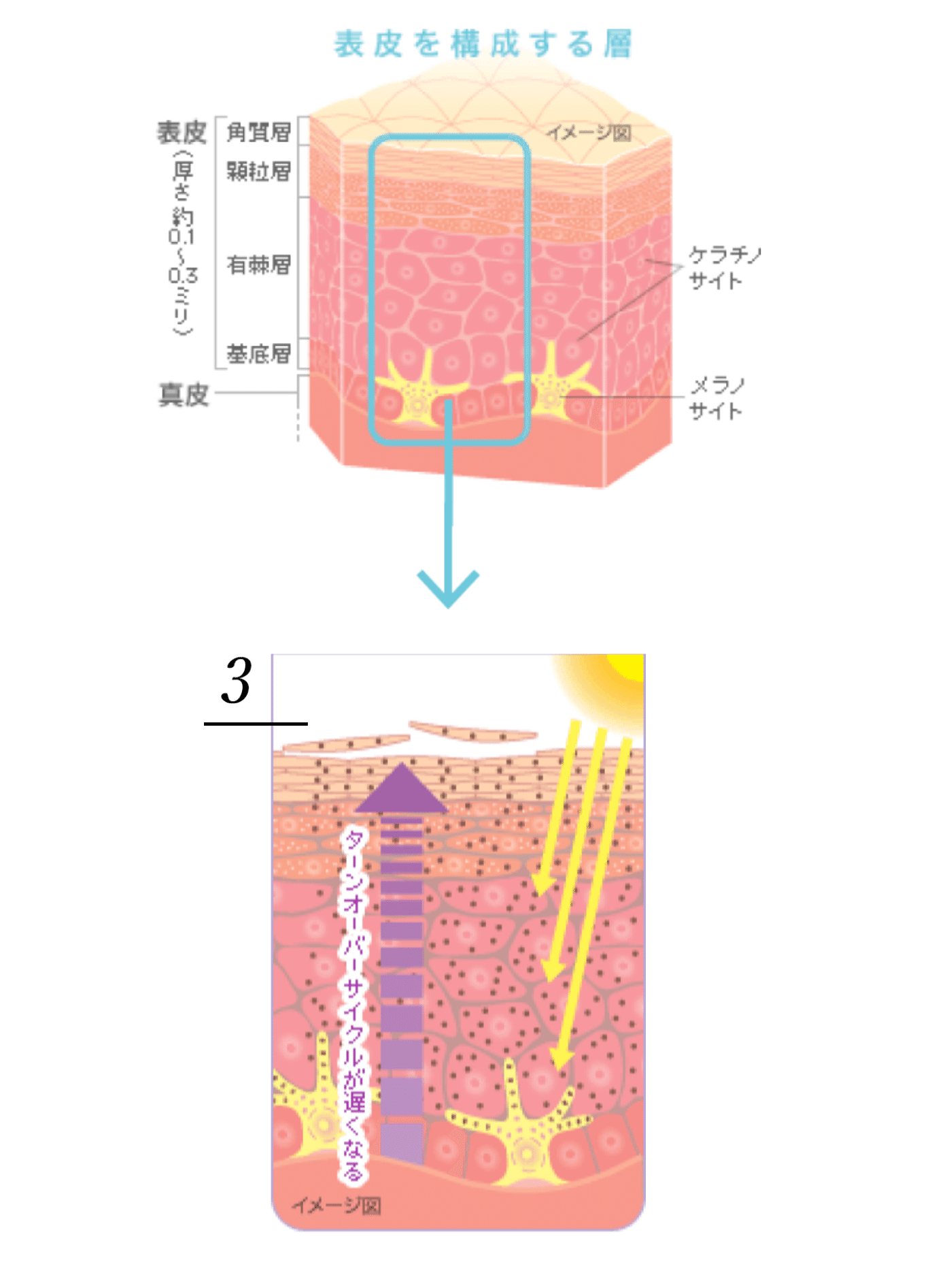 大量のメラニンの滞留がしみに