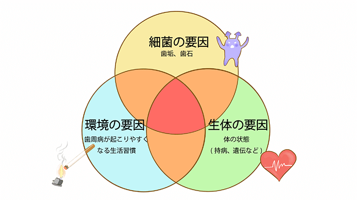 歯周病発症の要因