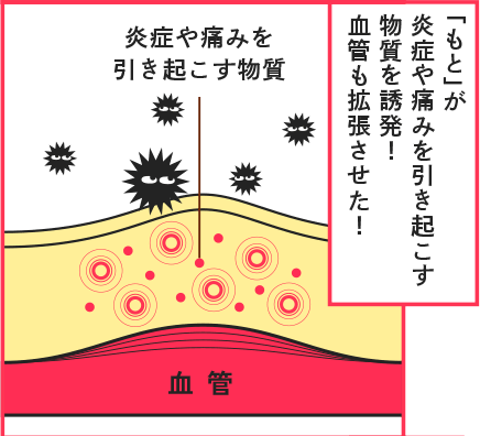 「もと」が炎症や痛みを引き起こす物質を誘発！血管も拡張させた！