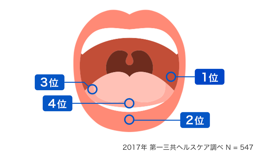 2017年 第一三共ヘルスケア調べN=547