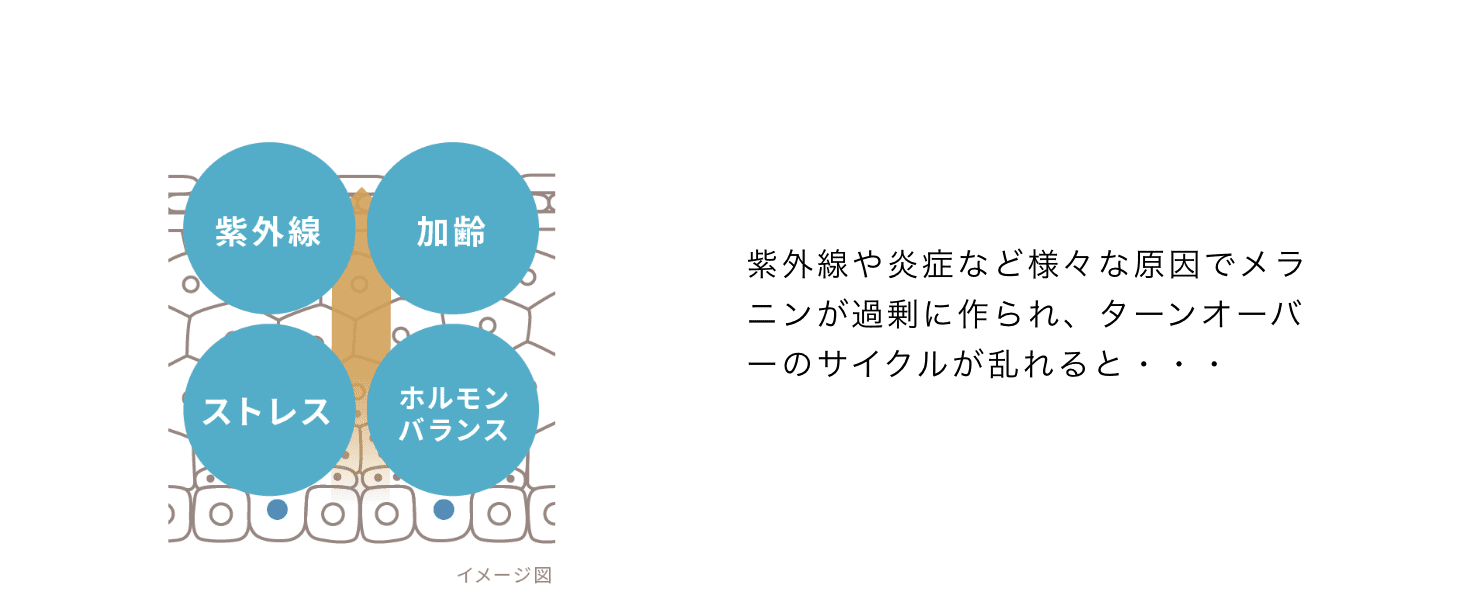 紫外線や炎症など様々な原因でメラニンが過剰に作られ、ターンオーバーのサイクルが乱れると・・