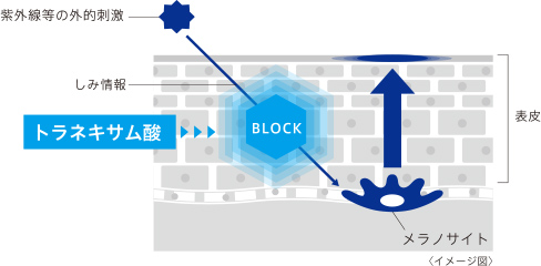 トラネキサム酸でブロック